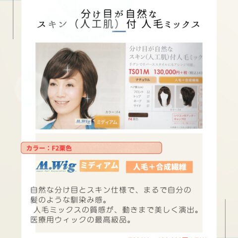 wig-f01